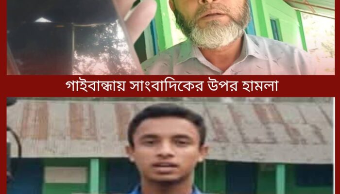 গাইবান্ধায় শিক্ষকদের অনুপস্থিতির তথ্য সংগ্রহকালে সাংবাদিকের ওপর হামলা, ক্যামেরা ভাঙচুর