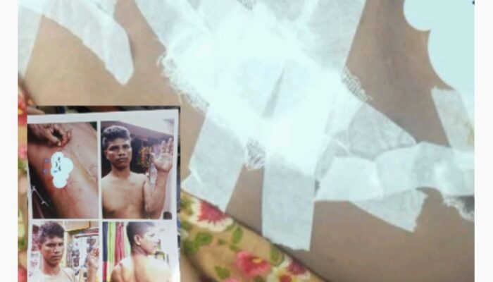 জমি-জমার বিরোধে দম্পতির ওপর হামলা, স্ত্রীকে ধারালো অস্ত্রে আঘাত; হাসপাতালে স্বামী ও স্ত্রী চিকিৎসাধীন